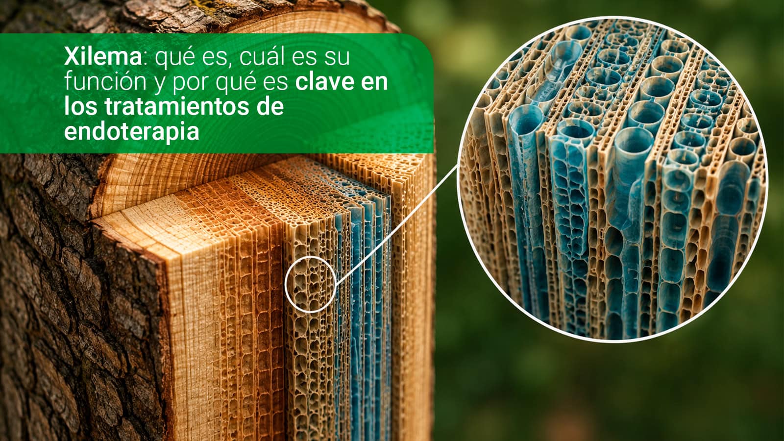 xilema-arbol